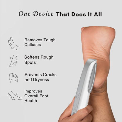 Callus Remover